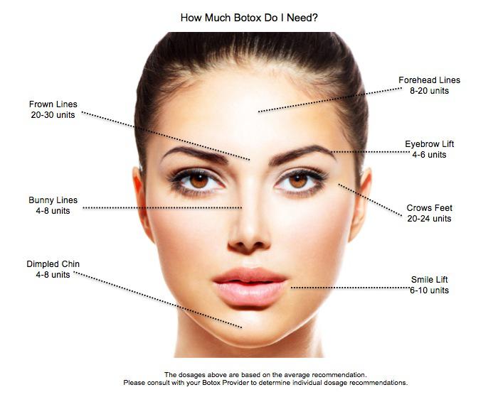 botox-how-much-graphic - DMH Aesthetics